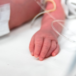 Nova Proteção para Bebês Prematuros no SUS Revoluciona Cuidados com a Bronquiolite