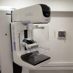 Equipamento de mamografia em uma sala hospitalar, com profissionais de saúde ao fundo.
